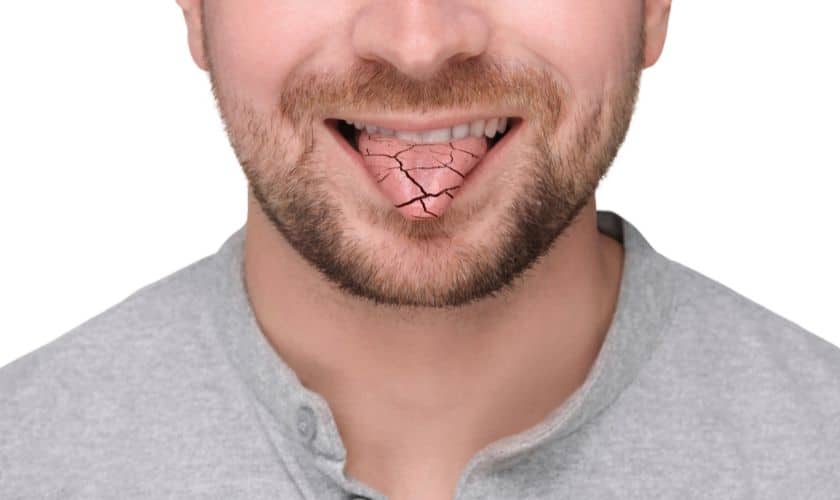 gum disease in houston