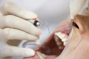 Dentist administering local anesthetic injection to patient's gum during periodontal procedure.