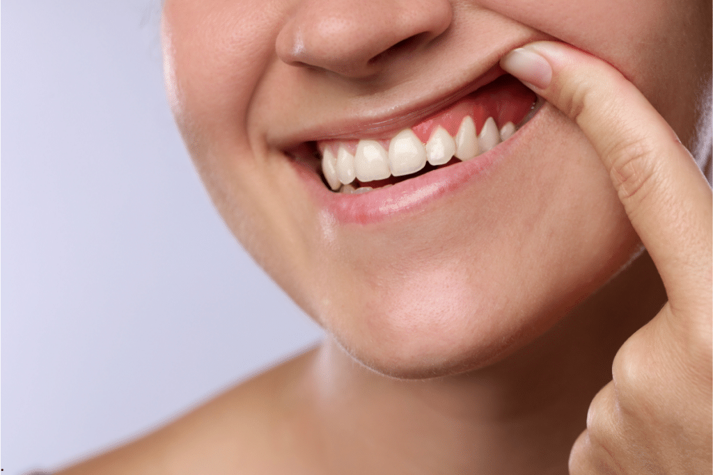Guide to Protecting Your Gums in Houston TX