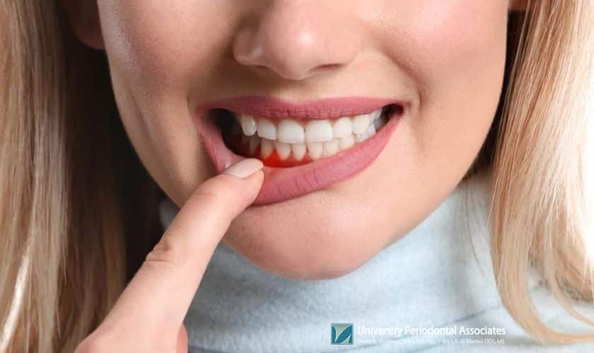 Periodontal Treatment in Houston