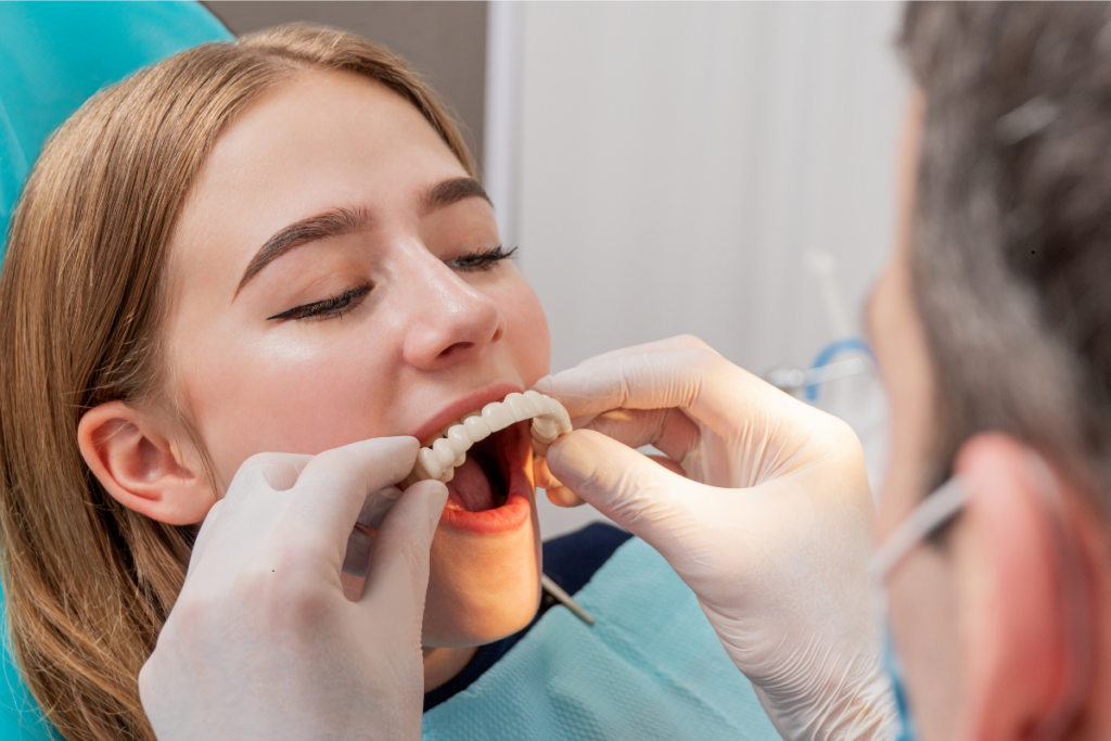 Implant Denture Houston