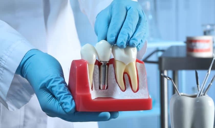 Dental implant in houston tx