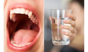 hydration for dry mouth