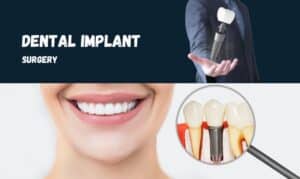 Dental implant surgery diagram showing tooth replacement components and healthy smile result.