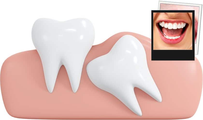 Different types of teeth and their role in chewing and digestion