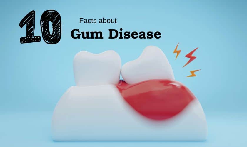gum disease facts