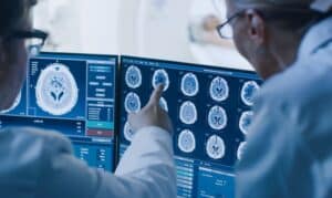 Dentist reviewing brain scan images on computer monitors before dental implant procedure.