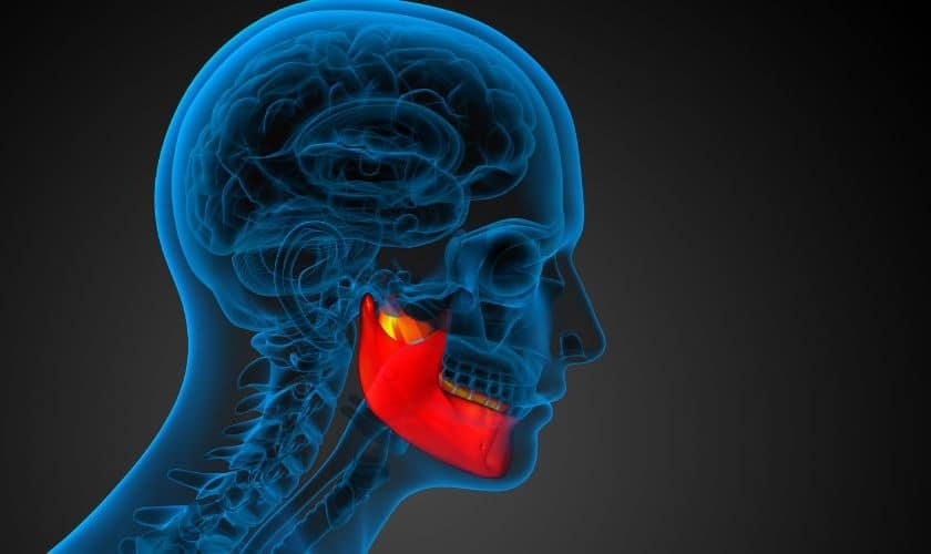3D anatomical illustration of human jaw bone highlighted in red, showing dental implant structure for Houston dental patient.