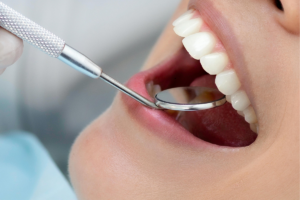 Gingival Flap procedure