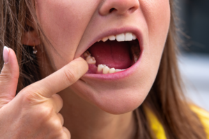 knocked out tooth treatment in Houston