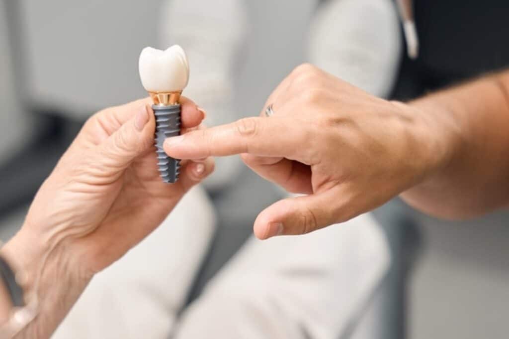 Dental Implants Houston