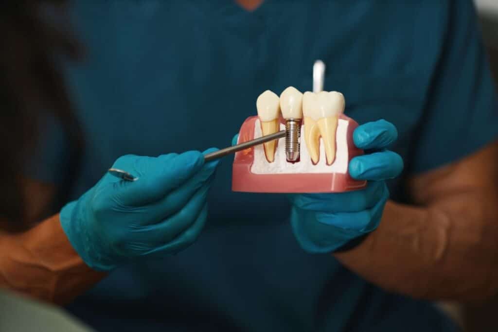 dental implants houston tx